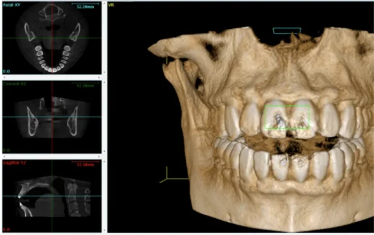 Tomografía computarizada Cone Beam en 3D